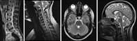 open mri diagnostic center - 1